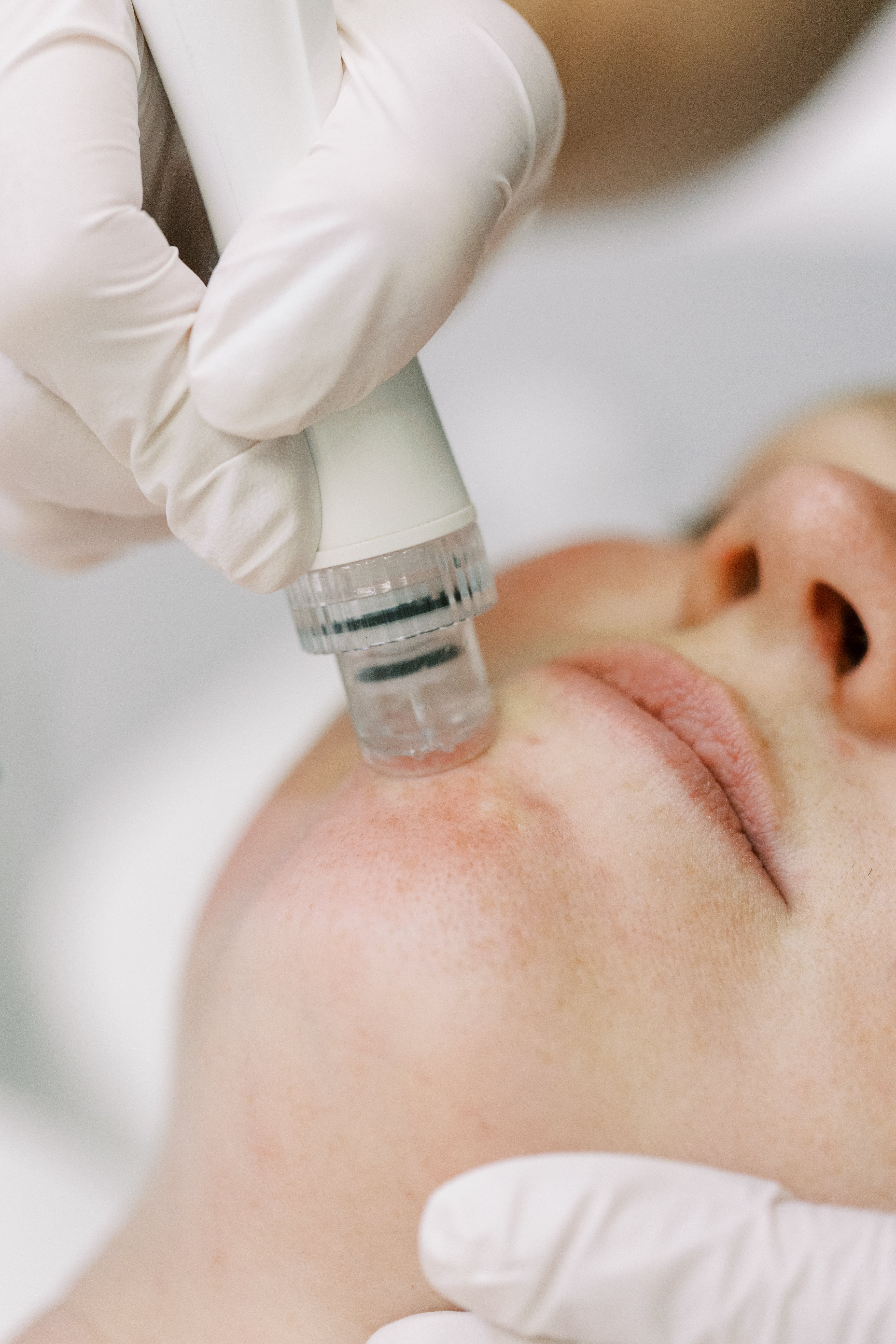 MyAestheticsDr_microdermabrasionandhydrodermabrasion.jpg